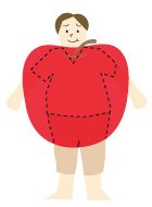 内蔵脂肪型肥満（りんご型）