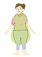 皮下脂肪型肥満（洋なし型）